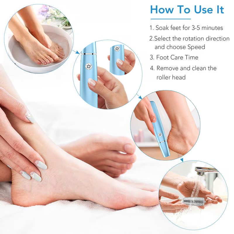 Electric Feet Callus Remover?