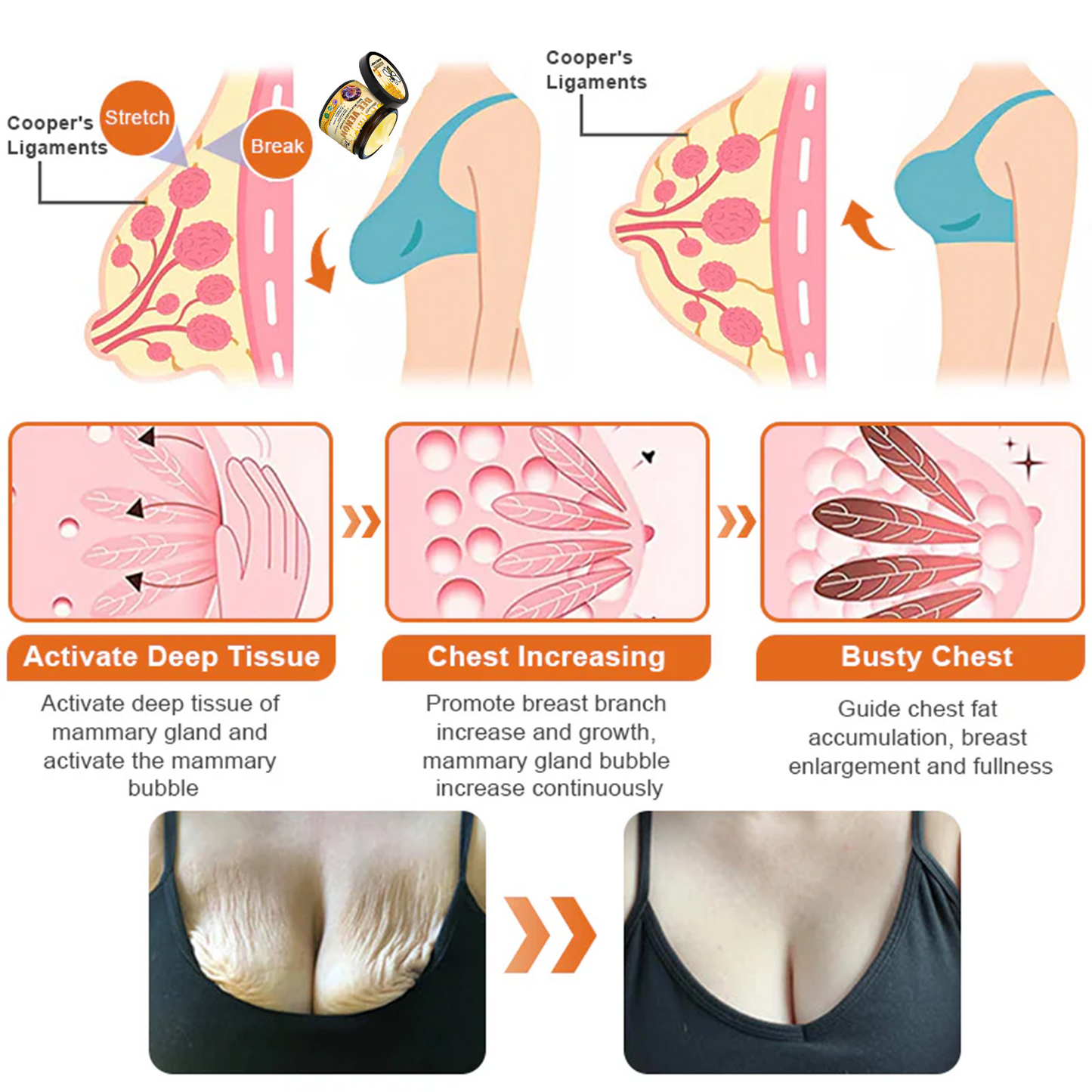 FDA Approved: Ringmiz Bee Venom Skin Restoration Cream — 🔥Limited Time 70% OFF🔥