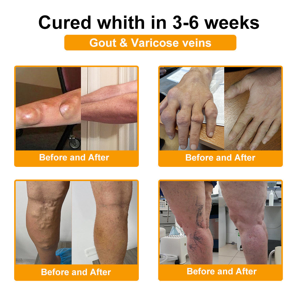 🎁Flash Sale - Ringmiz Botulinum Toxin & Bee Venom Pain-Relief Bone Healing Cream🐝💎