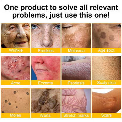 FDA Approved: Ringmiz Bee Venom Skin Restoration Cream — 🔥Limited Time 70% OFF🔥