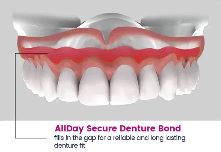 AllDay Secure Denture Bond