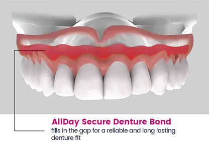 AllDay Secure Denture Bond