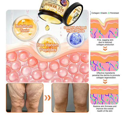 FDA Approved: Ringmiz Bee Venom Skin Restoration Cream — 🔥Limited Time 70% OFF🔥