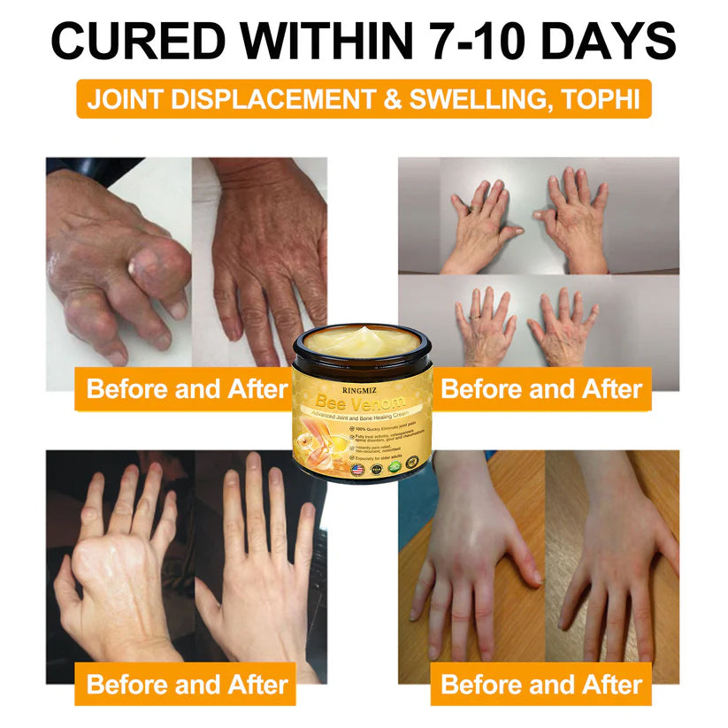 RINGMIZ Bee Venom Advanced Joint and Bone Healing Cream