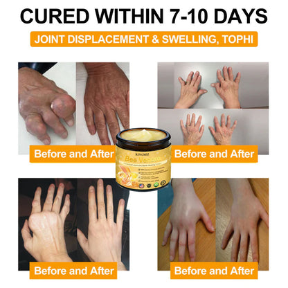 RINGMIZ Bee Venom Advanced Joint and Bone Healing Cream