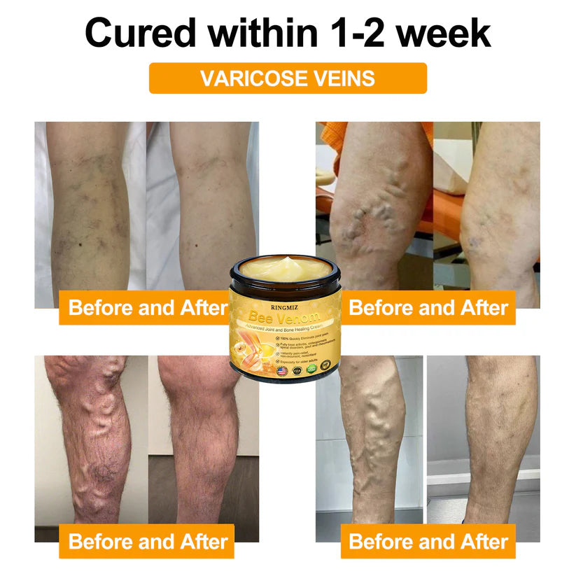 RINGMIZ Bee Venom Advanced Joint and Bone Healing Cream