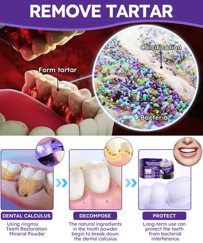 Ringmiz Teeth Restoration Mineral Powder