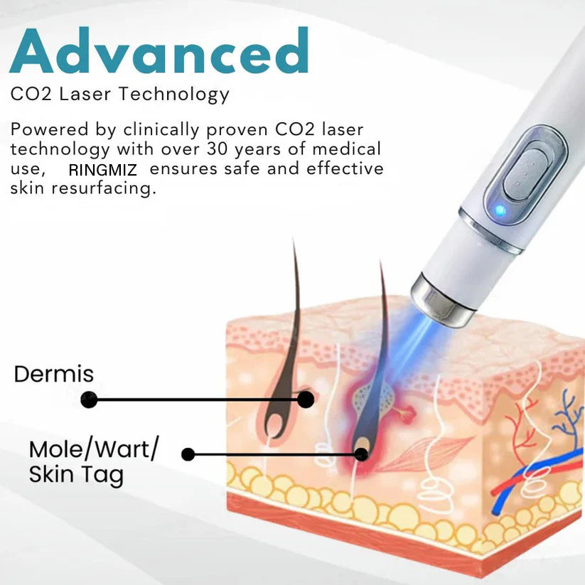 🔥【OFFICIAL STORE】Non-Invasive Mole and Wart Removal Laser Pen