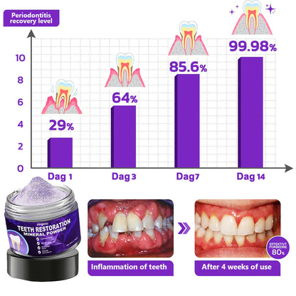 Ringmiz Teeth Restoration Mineral Powder