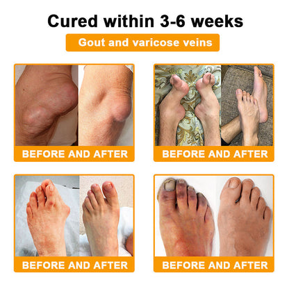 🎁Flash Sale - Ringmiz Botulinum Toxin & Bee Venom Pain-Relief Bone Healing Cream🐝💎