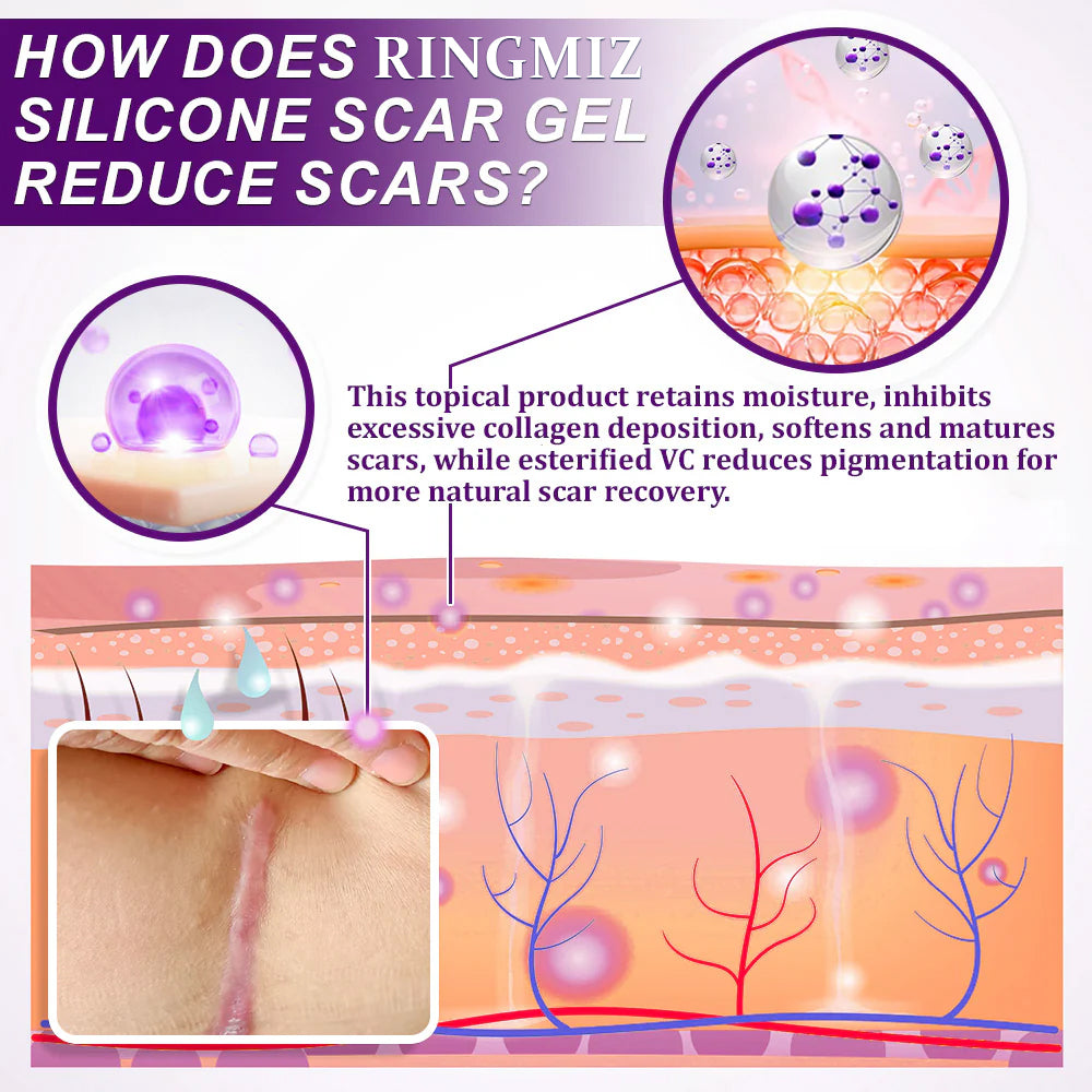 💙💙UKCA-CERTIFIED ✅RINGMIZ cure FACE & BODY SCAR GEL – Clinically proven to soften, flatten and fade surgical scars, acne marks, burns, keloids and trauma-related scars.