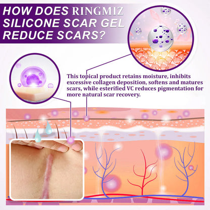 💙💙UKCA-CERTIFIED ✅RINGMIZ cure FACE & BODY SCAR GEL – Clinically proven to soften, flatten and fade surgical scars, acne marks, burns, keloids and trauma-related scars.