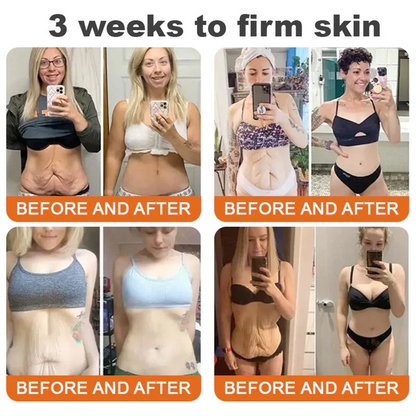 FDA Approved: Ringmiz Bee Venom Skin Restoration Cream — 🔥Limited Time 70% OFF🔥