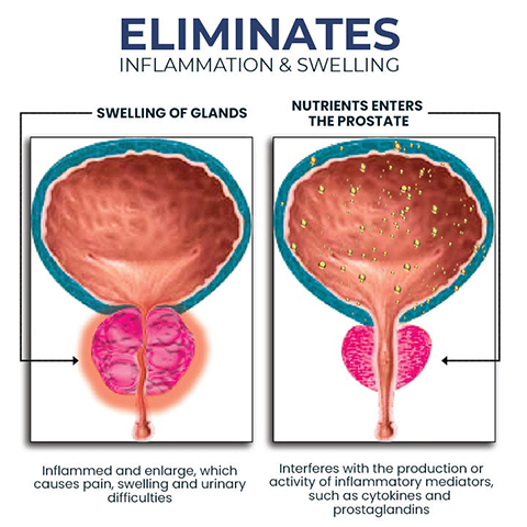 RINGMIZ BeeBoom NASAL INHALER FOR PROSTATE WELLNESS