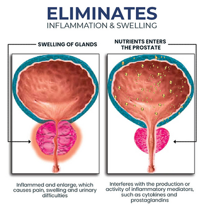 RINGMIZ BeeBoom NASAL INHALER FOR PROSTATE WELLNESS
