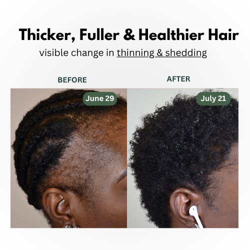 KLENIMORE™ Natural Hair Growth Oil