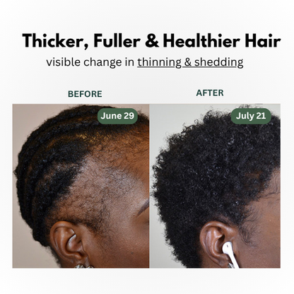 KLENIMORE™ Natural Hair Growth Oil