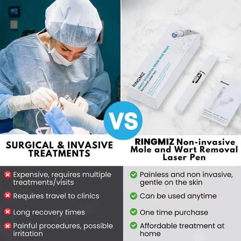 🔥【OFFICIAL STORE】Non-Invasive Mole and Wart Removal Laser Pen