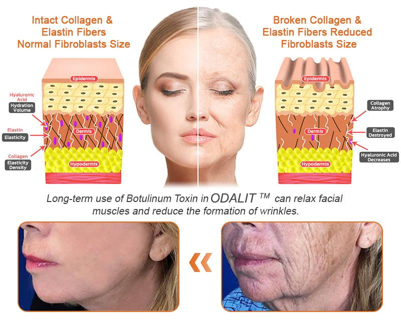 FDA Approved: Ringmiz Bee Venom Skin Restoration Cream — 🔥Limited Time 70% OFF🔥