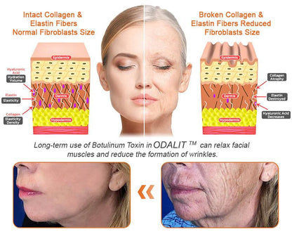 FDA Approved: Ringmiz Bee Venom Skin Restoration Cream — 🔥Limited Time 70% OFF🔥